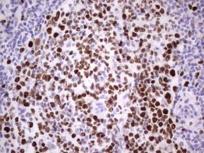 Immunohistochemistry: MCM2 Antibody (OTI3C12) [NBP2-45774]