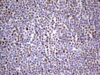 Immunohistochemistry: MCM2 Antibody (OTI3C12) [NBP2-45774]