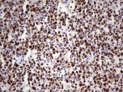 Immunohistochemistry: MCM2 Antibody (OTI3C12) [NBP2-45774]