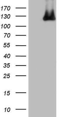 Western Blot: MCM2 Antibody (OTI3C12) [NBP2-45774]