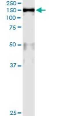 Immunoprecipitation: MCM2 Antibody (6A8) [H00004171-M01]
