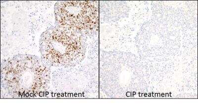 Immunohistochemistry: MCM2 Antibody (BLR108H) [NBP3-07021]