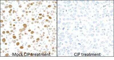 Immunohistochemistry: MCM2 Antibody (BLR108H) [NBP3-07021]
