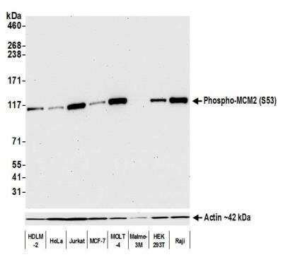 Western Blot: MCM2 Antibody (BLR108H) [NBP3-07021]