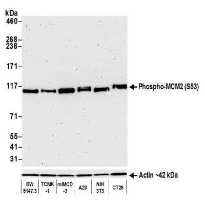 Western Blot: MCM2 Antibody (BLR108H) [NBP3-07021]