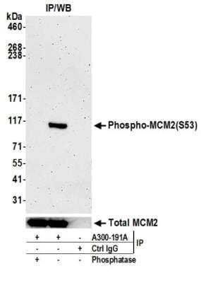 Western Blot: MCM2 Antibody (BLR108H) [NBP3-07021]