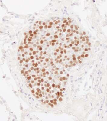 Immunohistochemistry-Paraffin: MCM2 Antibody [NB100-288]