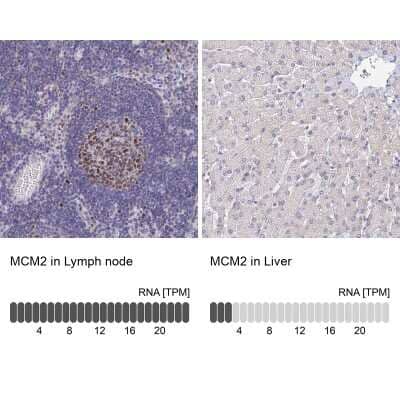 Immunohistochemistry-Paraffin: MCM2 Antibody [NBP2-33953]