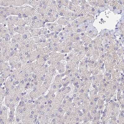 Immunohistochemistry-Paraffin: MCM2 Antibody [NBP2-33953]