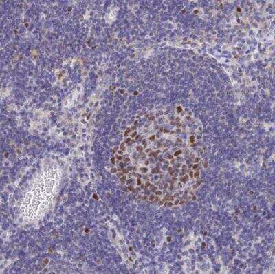 Immunohistochemistry-Paraffin: MCM2 Antibody [NBP2-33953]