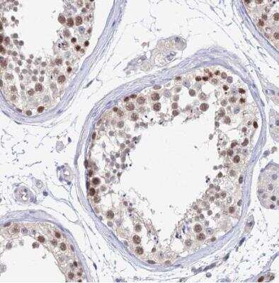 Immunohistochemistry-Paraffin: MCM2 Antibody [NBP2-33953]