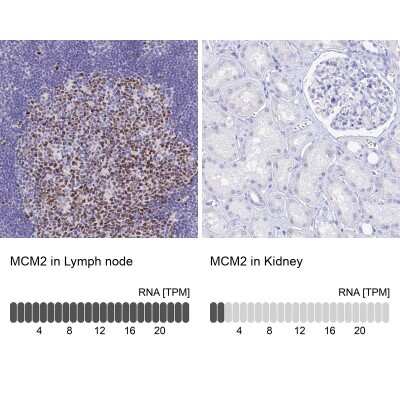 Immunohistochemistry-Paraffin: MCM2 Antibody [NBP2-33954]