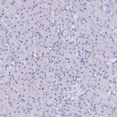 Immunohistochemistry-Paraffin: MCM2 Antibody [NBP2-33954]
