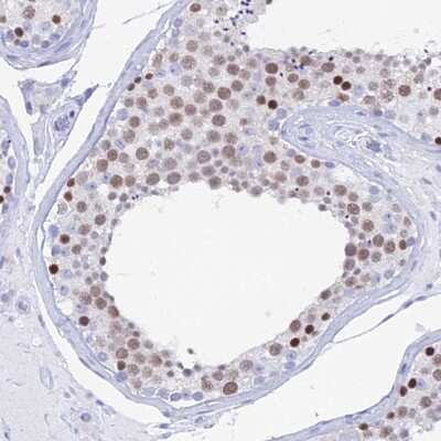 Immunohistochemistry-Paraffin: MCM2 Antibody [NBP2-33954]