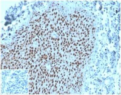 Immunohistochemistry-Paraffin: MCM2 Antibody (MCM2/3678) [NBP3-13965]