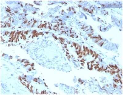 Immunohistochemistry-Paraffin: MCM2 Antibody (MCM2/3678) [NBP3-13965]