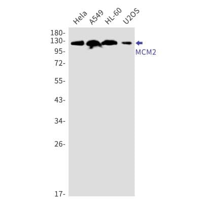 Western Blot: MCM2 Antibody (S02-0D3) [NBP3-19887]