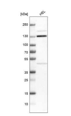 Western Blot: MCM2 Antibody [NBP2-33953]