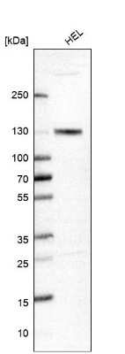 Western Blot: MCM2 Antibody [NBP2-33954]