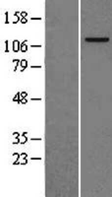 Western Blot: MCM2 Overexpression Lysate [NBL1-12950]