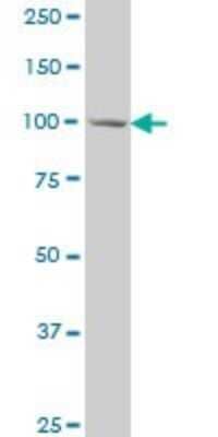 Western Blot: MCM3 Antibody (3E1) [H00004172-M03]