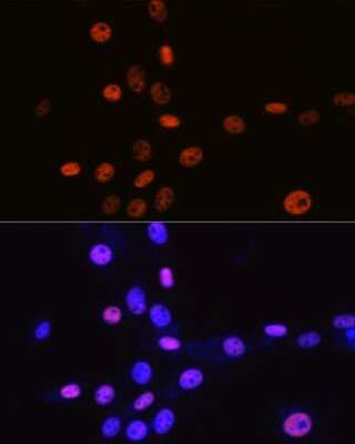 Immunocytochemistry/ Immunofluorescence: MCM3 Antibody (9Z5W4) [NBP3-15386]