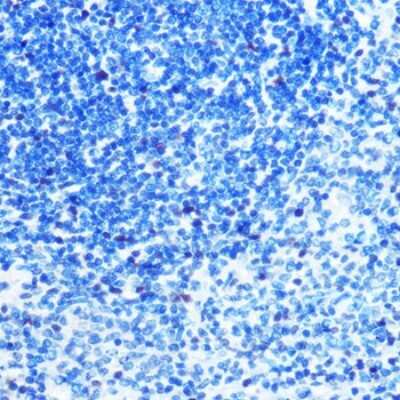 Immunohistochemistry-Paraffin: MCM3 Antibody (9Z5W4) [NBP3-15386]