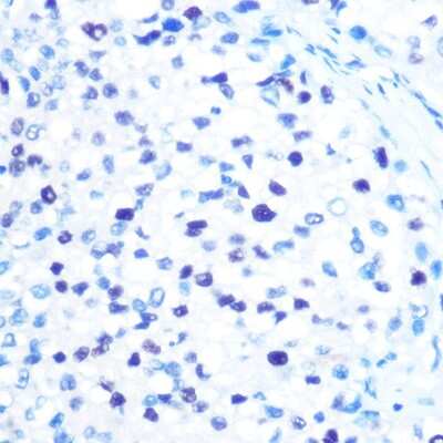 Immunohistochemistry-Paraffin: MCM3 Antibody (9Z5W4) [NBP3-15386]