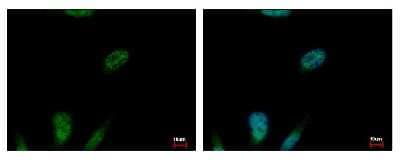 Immunocytochemistry/ Immunofluorescence: MCM3 Antibody [NBP1-33028]
