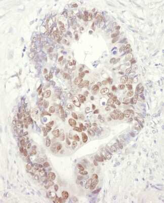 Immunohistochemistry: MCM3 Antibody [NB100-249]