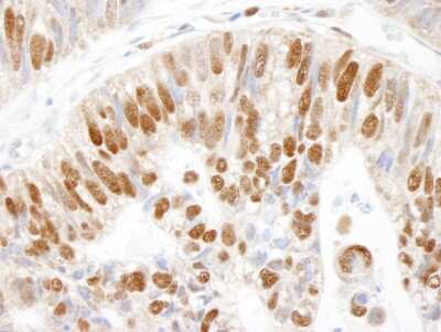 Immunohistochemistry: MCM3 Antibody [NB100-289]