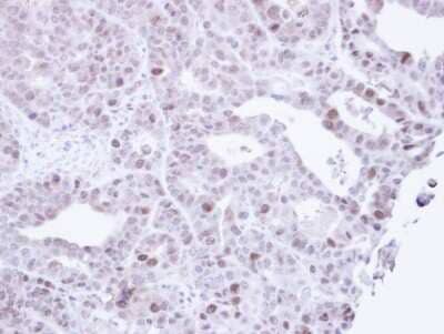 Immunohistochemistry-Paraffin: MCM3 Antibody [NBP1-33028]