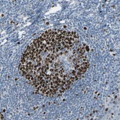Immunohistochemistry-Paraffin: MCM3 Antibody [NBP1-85797]