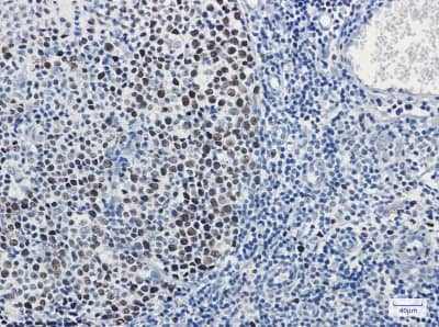 Immunohistochemistry-Paraffin: MCM3 Antibody (S04-6B9) [NBP3-19485]
