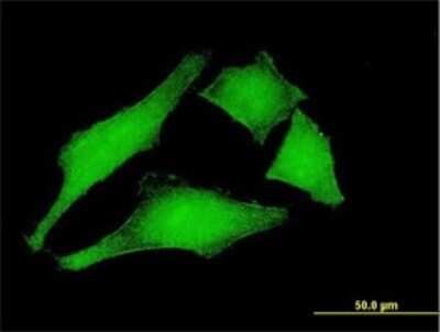 Immunocytochemistry/ Immunofluorescence: MCM3AP Antibody (1H3) [H00008888-M01]