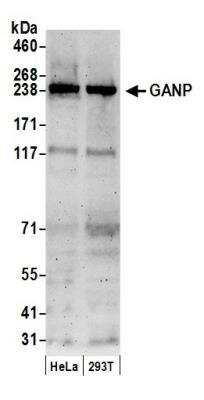 Western Blot: MCM3AP Antibody [NBP1-71882]