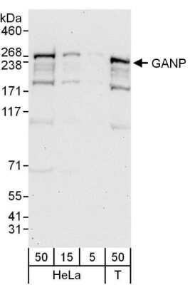 Western Blot: MCM3AP Antibody [NBP1-71883]