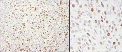 Immunohistochemistry: MCM4 Antibody [NB100-290]