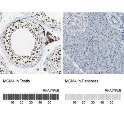 Immunohistochemistry-Paraffin: MCM4 Antibody [NBP1-85728]