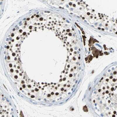 Immunohistochemistry-Paraffin: MCM4 Antibody [NBP1-85728]