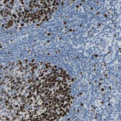 Immunohistochemistry-Paraffin: MCM4 Antibody [NBP1-85728]