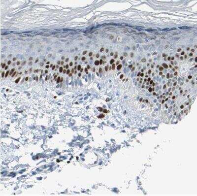 Immunohistochemistry-Paraffin: MCM4 Antibody [NBP1-85728]