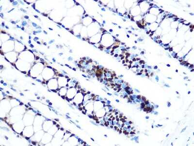 Immunohistochemistry-Paraffin: MCM5 Antibody (4P1Q5) [NBP3-16529]