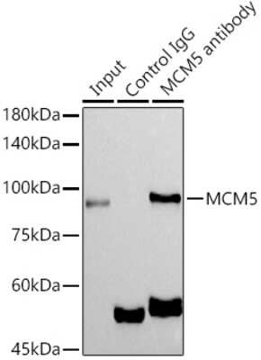 Immunoprecipitation: MCM5 Antibody (4P1Q5) [NBP3-16529]