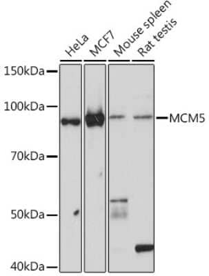 Western Blot: MCM5 Antibody (4P1Q5) [NBP3-16529]