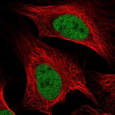 Immunocytochemistry/ Immunofluorescence: MCM5 Antibody [NBP2-55587]