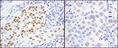Immunohistochemistry-Paraffin: MCM5 Antibody [NB100-79778]