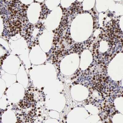 Immunohistochemistry-Paraffin: MCM5 Antibody [NBP1-85722]