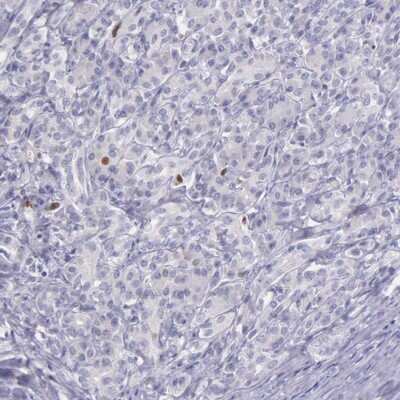 Immunohistochemistry-Paraffin: MCM5 Antibody [NBP1-85722]