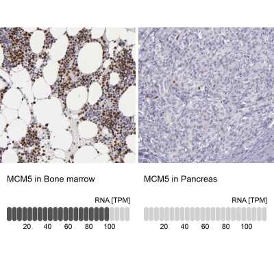 Immunohistochemistry-Paraffin: MCM5 Antibody [NBP1-85722]